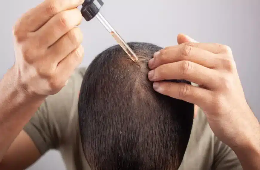 Minoxidil