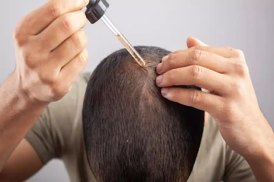 Minoxidil