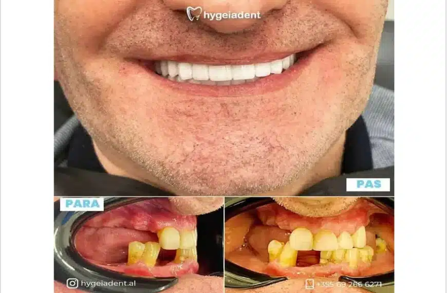 Oral Health