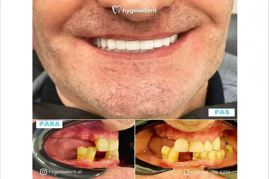 Oral Health