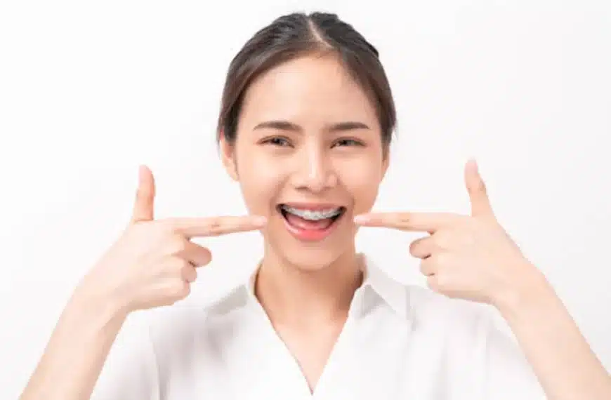 Affordable Dental Braces in Singapore High Quality at Low Cost