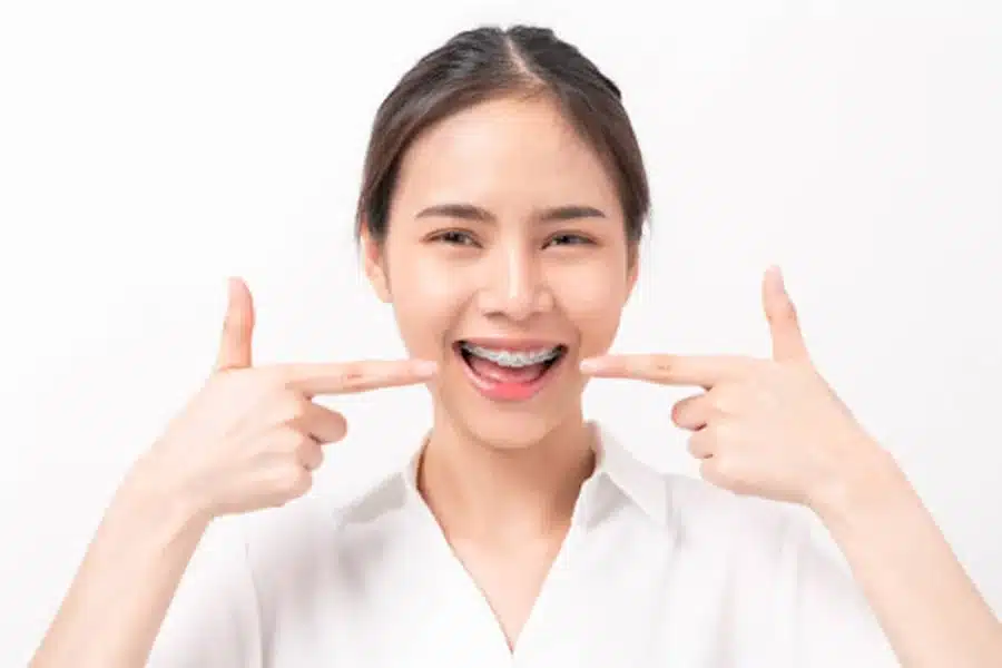 Affordable Dental Braces in Singapore High Quality at Low Cost