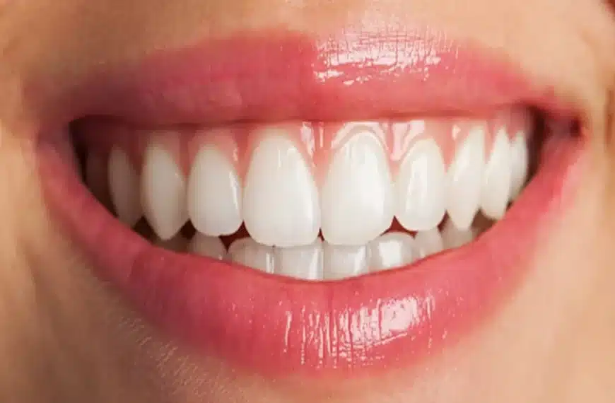 Brighter Smile