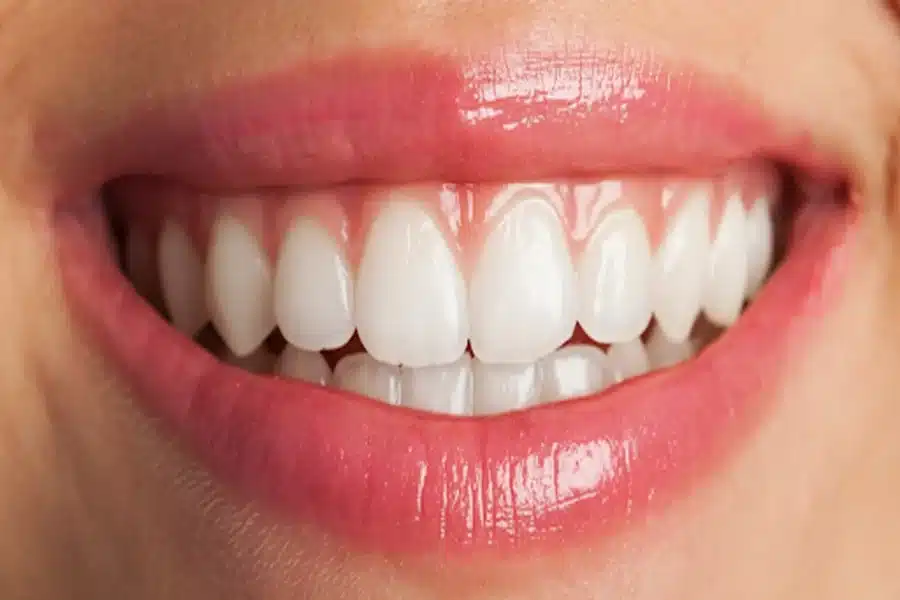 Brighter Smile
