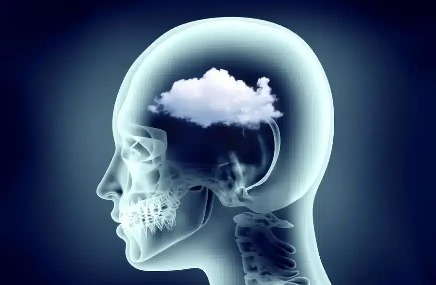 Brain