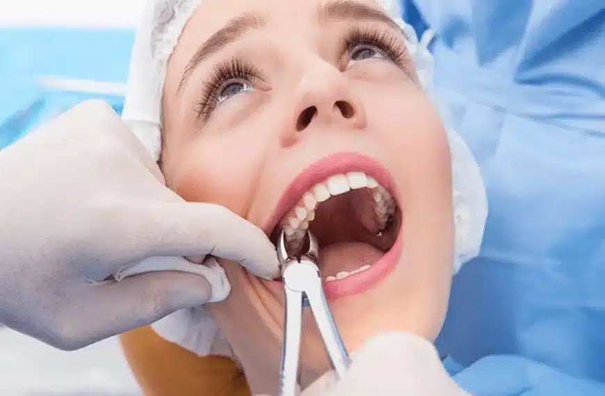 Tooth Removal